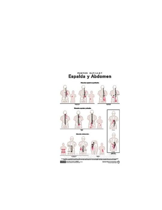 Lámina Puntos Gatillo Espalda y Abdomen