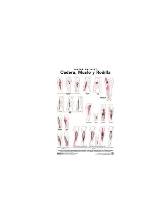 Lámina Puntos Gatillo Cadera, Muslo y Rodilla